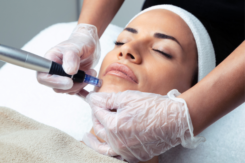 Dermapen glow con efecto BB Skin en Boadilla del Monte